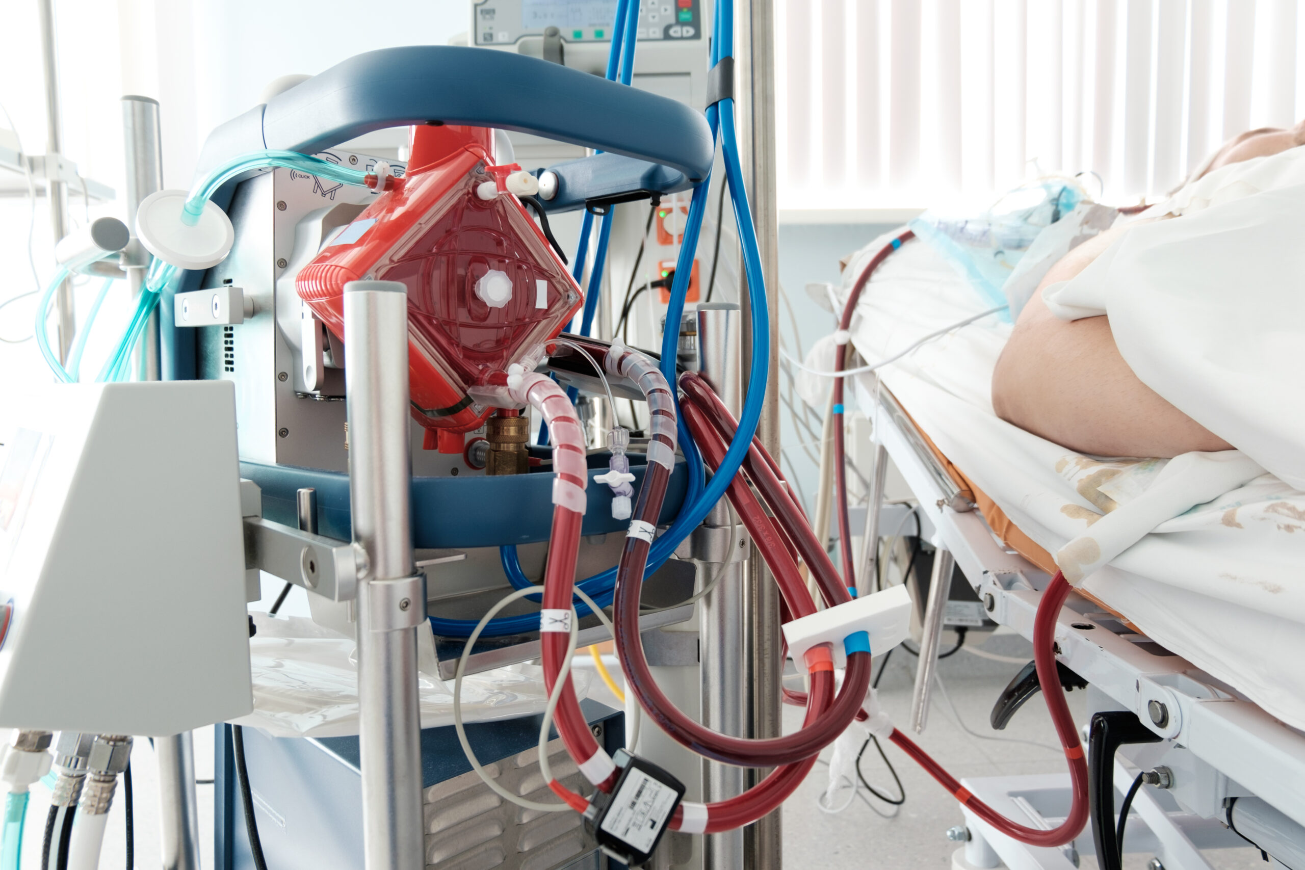 ECMO